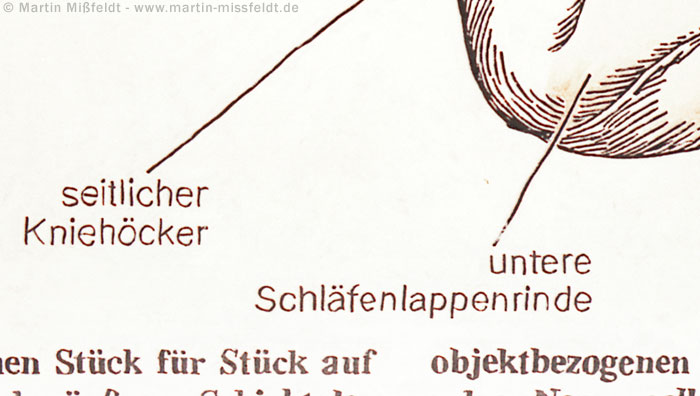 seitlicher Kniehöcker - untere Schläfenlappenrinde | Ölbild