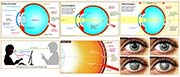 Infografiken: Auge und Sehen