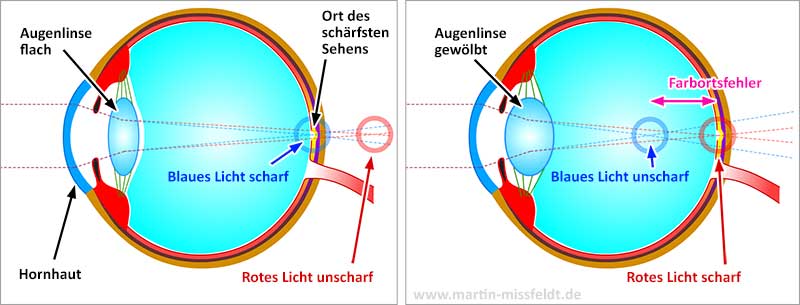 Farbortsfehler: Aufgrund der Wellenlängenunterschiede von Rot und Blau werden entweder blaue Gegenstände scharf gesehen oder rote
